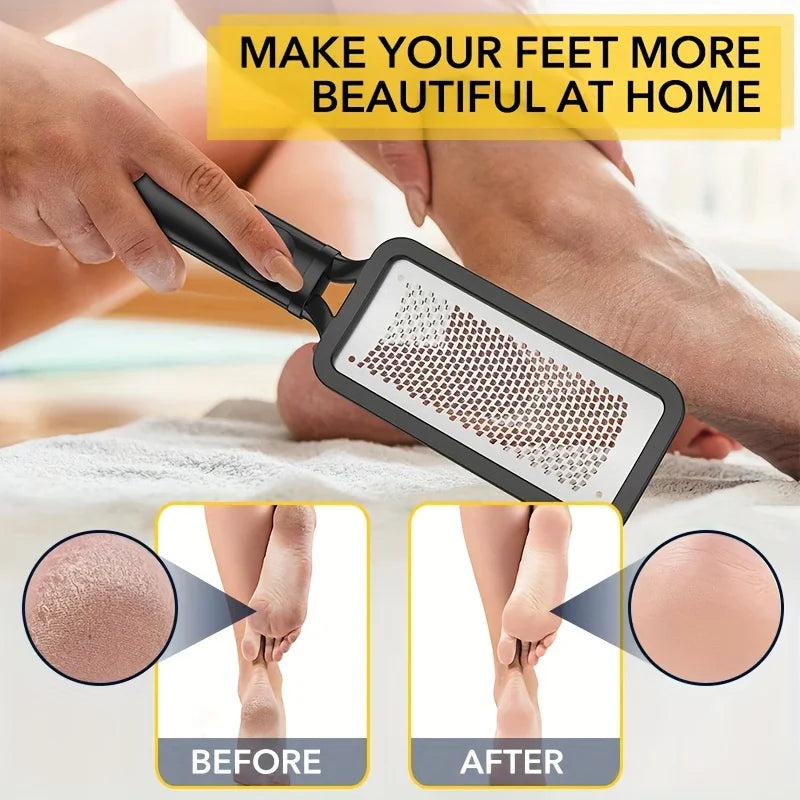 Professional Stainless Steel Foot File Callus Remover (Pay only for the product – no tax, no shipping fees!)