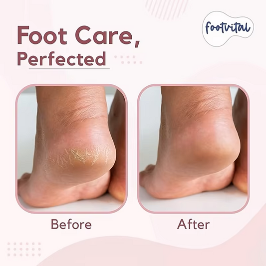 Professional Stainless Steel Foot File Callus Remover (Pay only for the product – no tax, no shipping fees!)