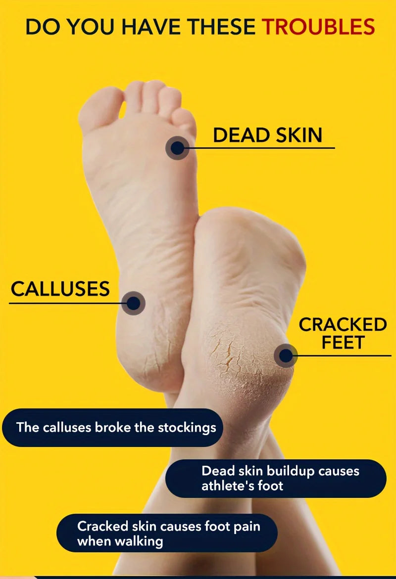 Professional Stainless Steel Foot File Callus Remover (Pay only for the product – no tax, no shipping fees!)